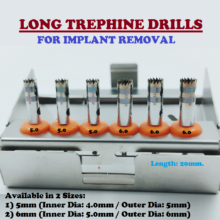 Long Trephine for Implant Removal Jull-Dent 124 Used for retrieval of implants. For harvesting bone in autogenous bone graft placement. Manufactured from Premium Quality Stainless Steel. Can be used with the Drill Guide Paralleling System to eliminate drill chatter during graft or implant harvesting. Sizes Available: 1) Jull-Dent 124A- 5.0 Inner Diameter: 4mm, Outer Diameter: 5mm 2) Jull-Dent 124B- 6.0 Inner Diameter: 5mm, Outer Diameter: 6mm
