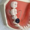 070 Freehand Flap Retractor - Image 8